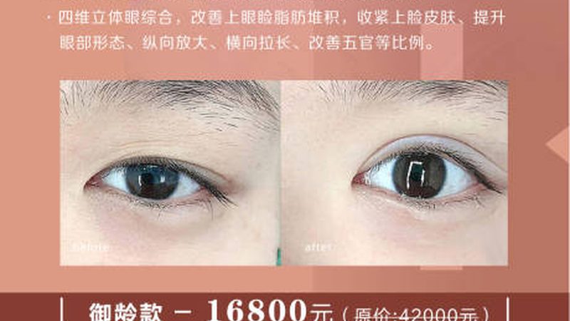 国产与进口水光针成分解析：揭秘成分差异背后的奥秘