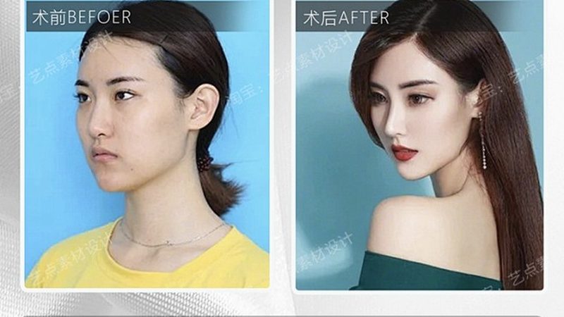 医美咨询师必备：案例学习全攻略