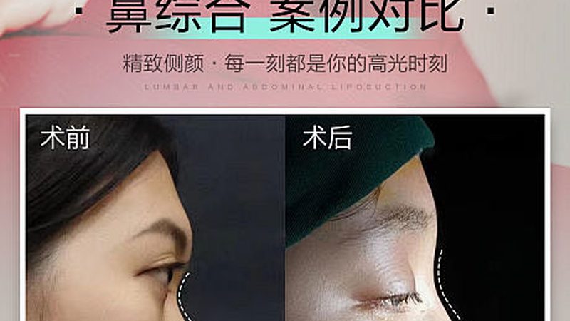 水光针恢复期，冷敷还是热敷？揭秘恢复期的正确护理方法**