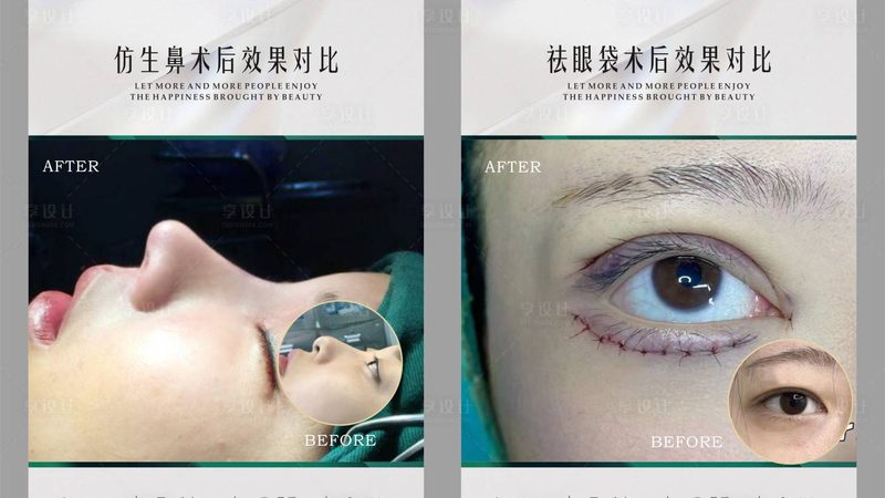 水光针新手怎么选型号