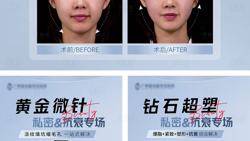 自体脂肪填充禁忌人群
