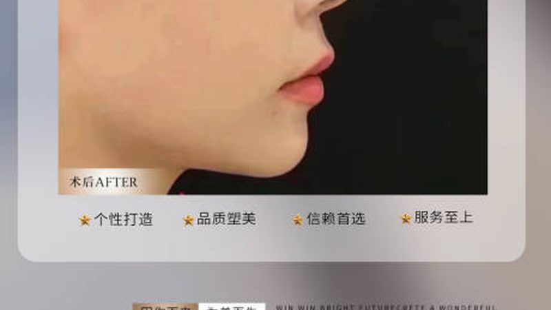 超声炮参数设置：揭秘最佳方案**