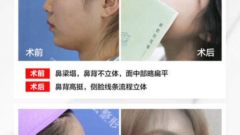 男士瘦脸面膜：揭秘如何挑选适合自己的产品