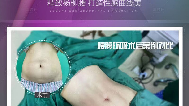 家用超声炮：揭秘其原理与作用**