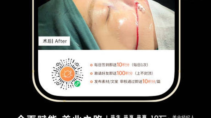 肉毒素下颌缘提升价格多少钱