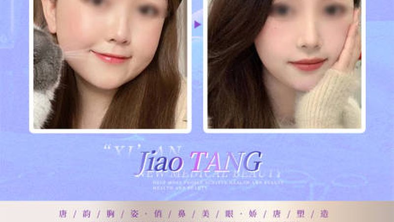 广州双眼皮手术，如何选择适合自己的价格？**