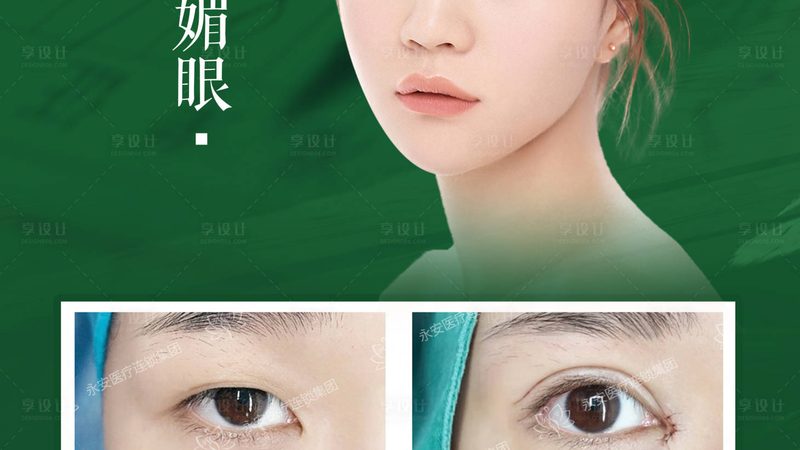 小标题：隆鼻，不仅仅是鼻子变挺