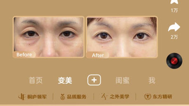 热玛吉如何选？揭秘靠谱医院的四大标准