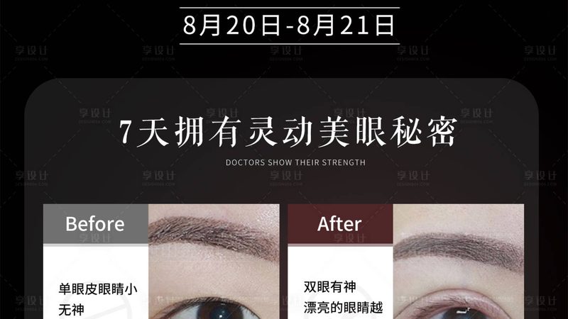 自体脂肪填充面部，消肿过程揭秘