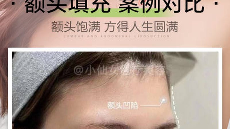 目前市场上常见的瘦脸技术主要有以下几种：